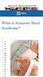 Mobile Screenshot of amnioticbandsyndrome.com